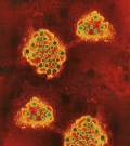 noroviruses