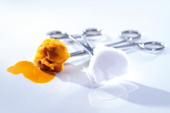 Long-term effect and remanence of alcohol-based skin antiseptics