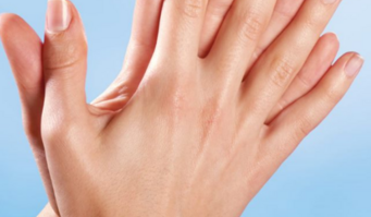 Journée de l’hygiène des mains 2023