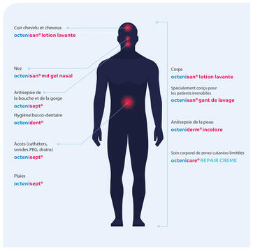 Assainissement ciblé des ERM