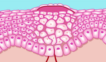 Effective wound management