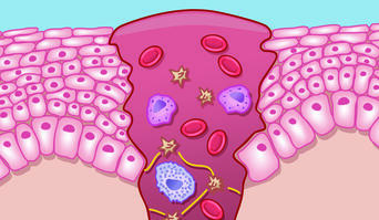 Phases of wound healing