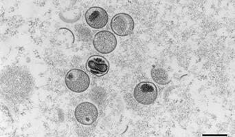 Wirksamkeit von Desinfektionsmitteln/Antiseptika gegen das Affenpockenvirus (MPXV)